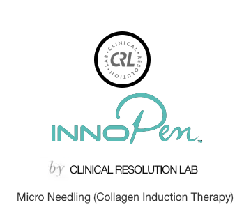 Hair-Restoration-Laval Micro-Needling-Collagen-Induction-Therapy-Laval-Innopen-Clinical-Resolution