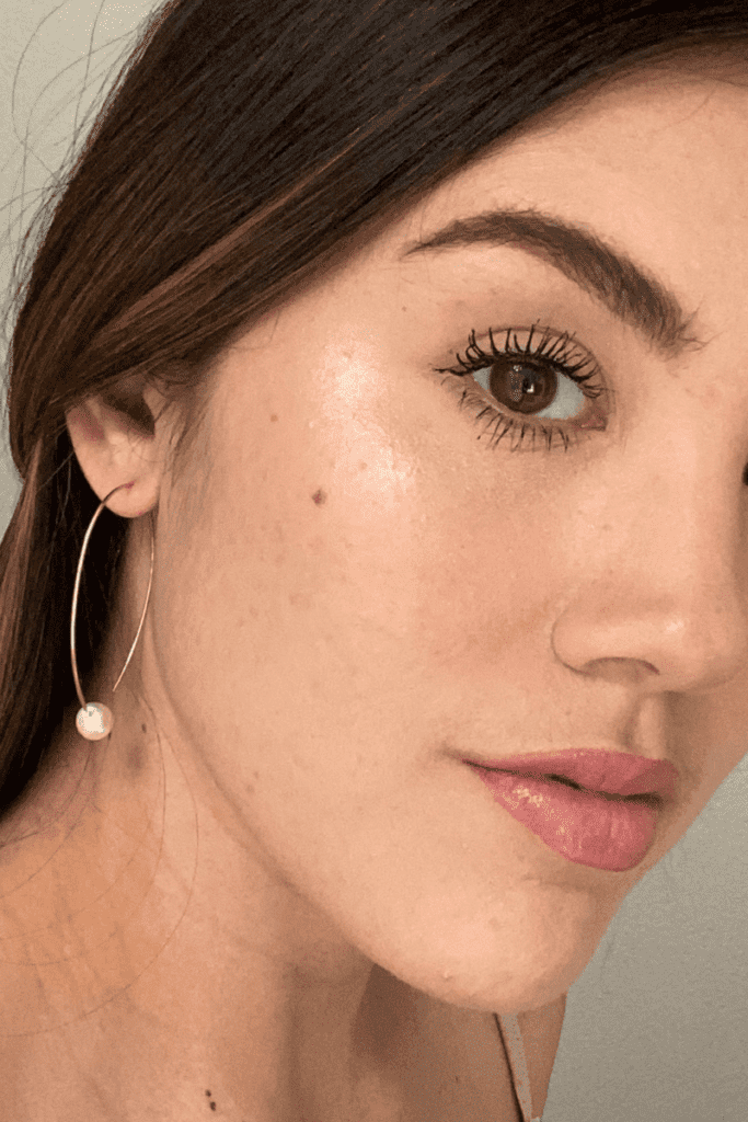Post-inflammatory-hyperpigmentation-treatment-near-me