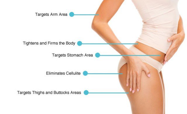 body sculpting treatments laval