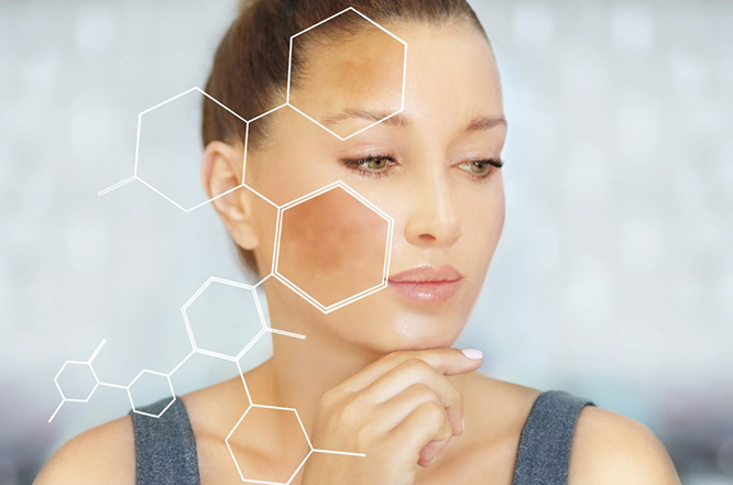 chloasma-treatment-laval