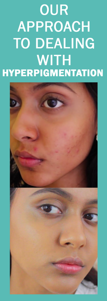 our-approach-to-hyperpigmentation