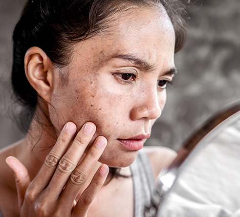 sun-spots-laval-quebec