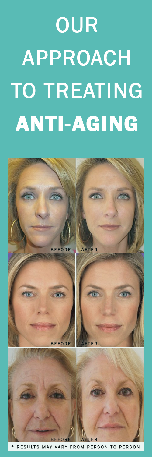 treating-anti-aging-laval-quebec