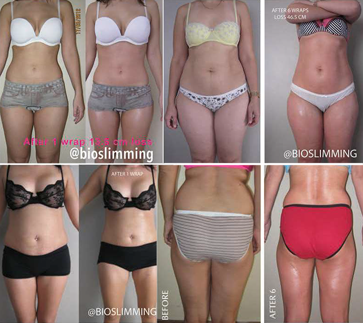 body-sculpting-treatment-near-me