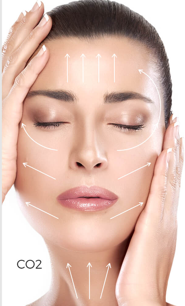 carboxytherapy-treatment-near-me-laval