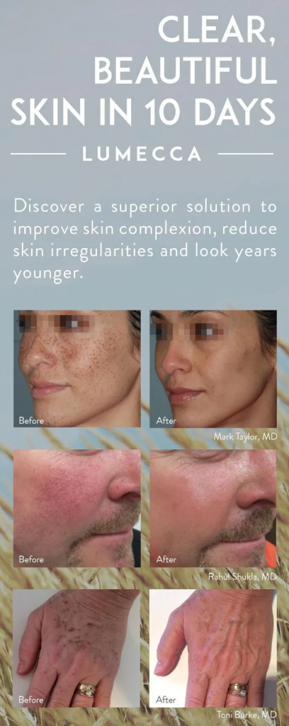 ipl-laval-treatment-before-after