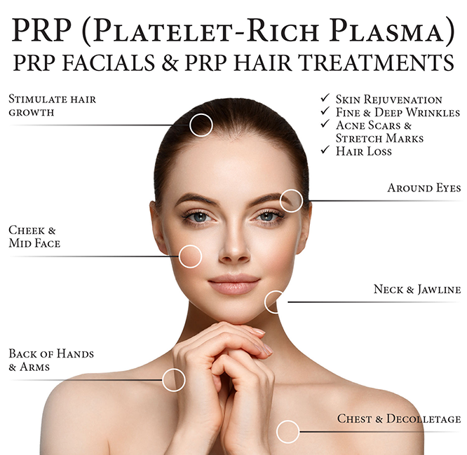 PRP-Platelet-Rich-Plasma-treatment-laval