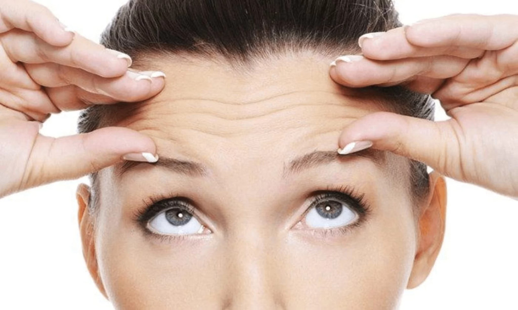 botox treatment laval for wrinkles by Clinique Medico Esthetique Complexion