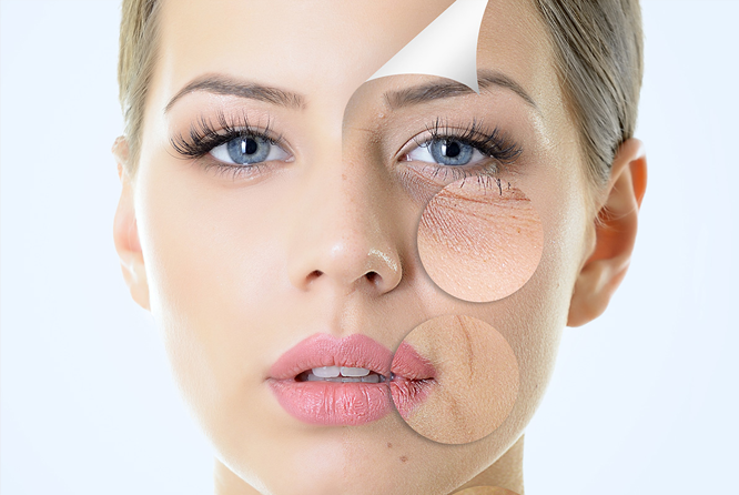 fine-lines-and-wrinkle-reduction